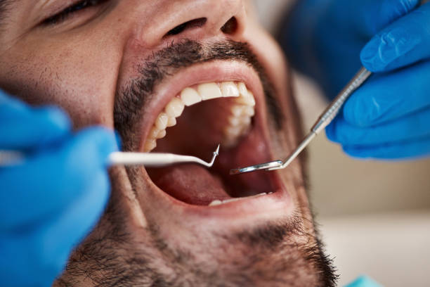 Best Emergency Treatment for Dental Infections or Abscesses in Frackville, PA
