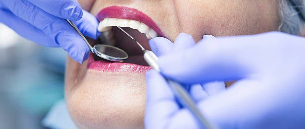 Best Emergency Root Canal Treatment in Frackville, PA